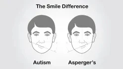 The Smile Difference: Autism vs. Asperger Syndrome