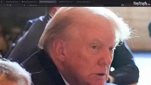 BIG REVEAL: Trump's Bandage Comes Off Showing... Minor Discoloration?  Can The Gaslighting Stop Now?